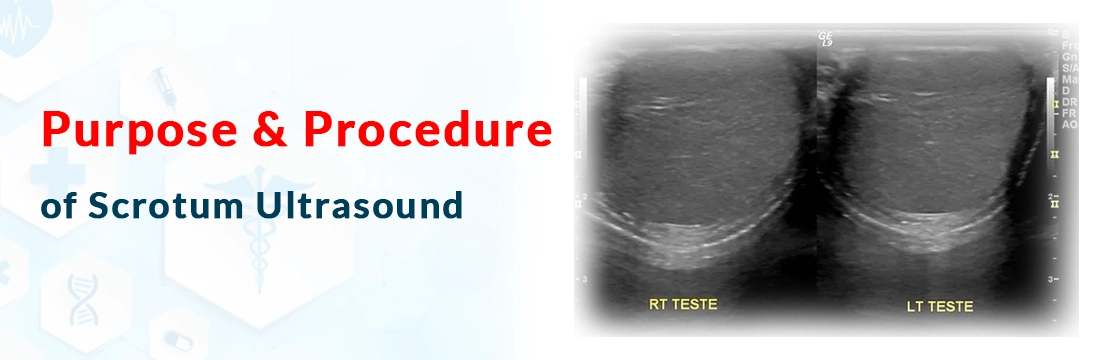 Purpose & Procedure of Scrotum Ultrasound